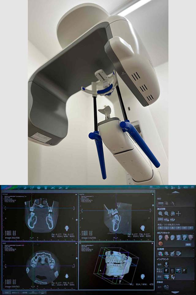 歯科用CT写真
